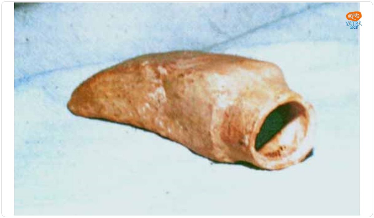 Rhyton