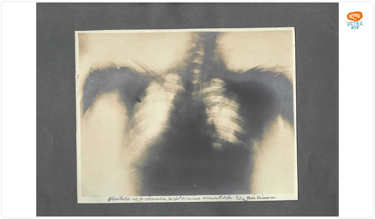 Radiografie (fotografie) a lui Ion I.C. Brătianu